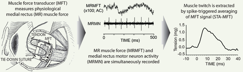 STS-MFT